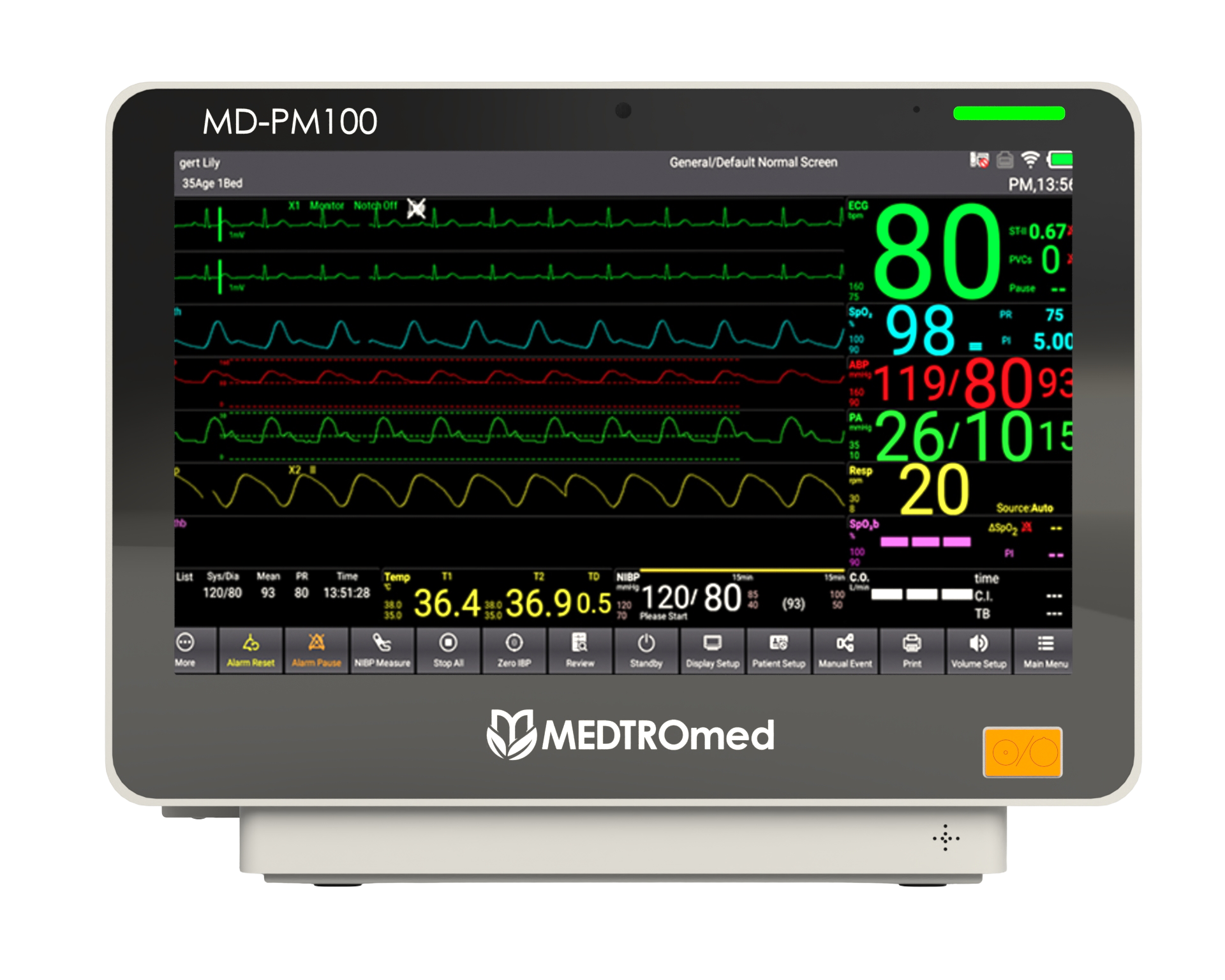 Patient Monitor 100 7 Parameter+Aag Modul (MD-PM100 7 Parameter+Aag Module)